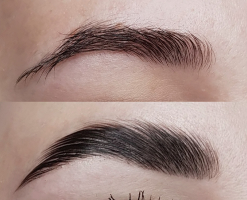 Brow Lifting Oberhausen