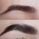 Brow Lifting Oberhausen