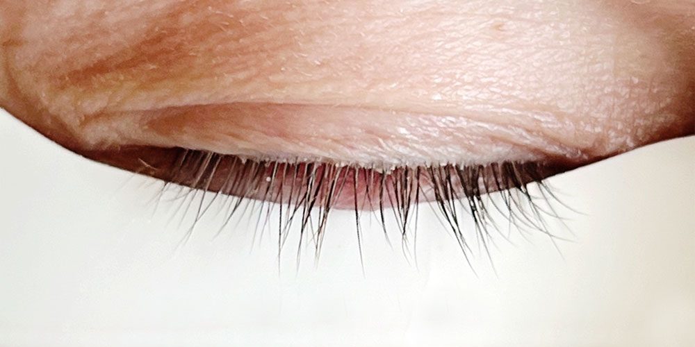 SPC-wimpernserum-testimonials-patrick-before