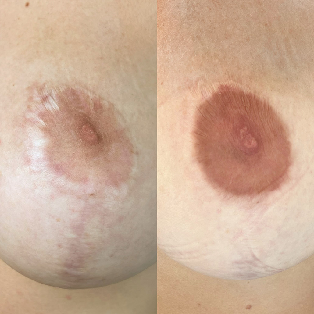 Medizinische Pigmentierung Permanent Make-up Köln - Sara Pavo