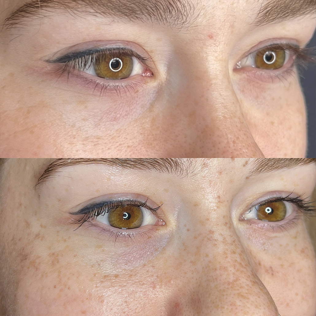 Fake Freckles | Permanent Make-up Köln - Sara Pavo