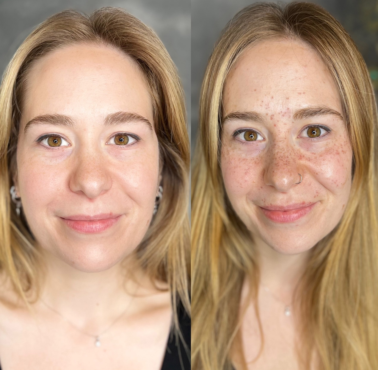 Sommersprossenpigmentierung | Permanent Make-up Köln - Sara Pavo