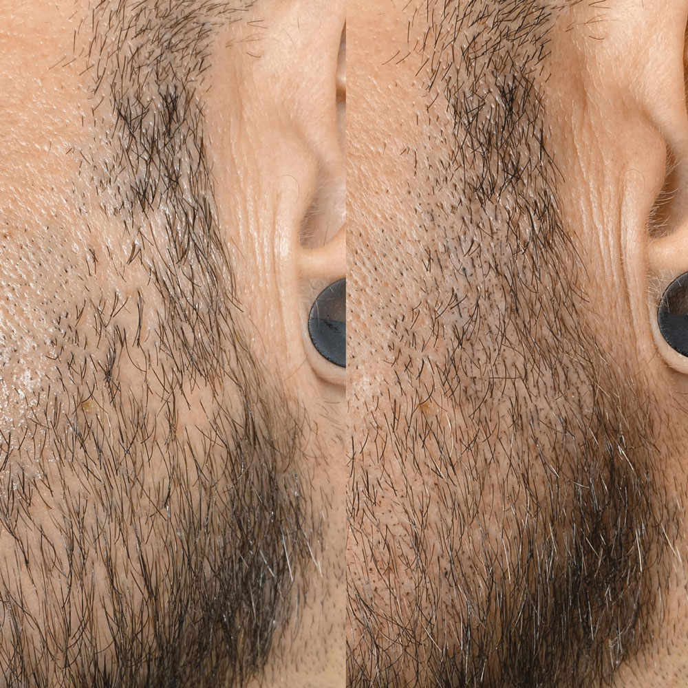 medizinische Pigmentierung Köln | Permanent Make-up Köln - Sara Pavo